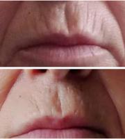 Αν αναζητάτε την πιο πολυτελή και ισχυρή κούρα αντιγήρανσης, τότε η ελληνική εταιρεία FBM ANAGENESSIS έχει την πρόταση νεότητας