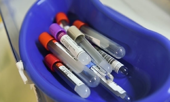 9 νέα κρούσματα κορονοϊού στον Έβρο ανακοίνωσε ο ΕΟΔΥ